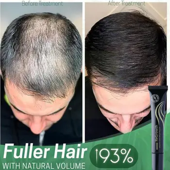  Çıkma Saç Sıvı Yoğun Saç Losyonu Rulo Seti Biotin Saç Büyüme Serumu Üçlü Roll-On Masaj Saç Büyüme Özü Tüm Saç